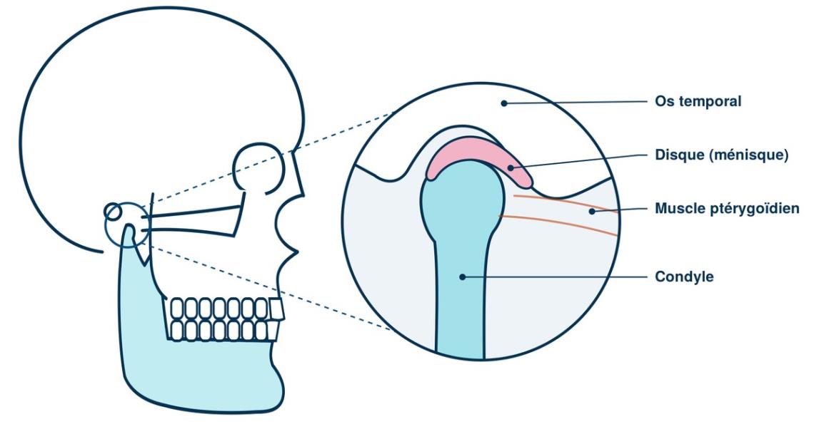 Schéma de l'articulation temporo-mandibulaire : os temporal, disque, condyle et muscle ptérygoïdien