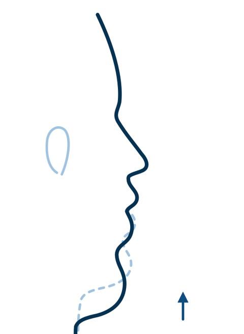 Visage long