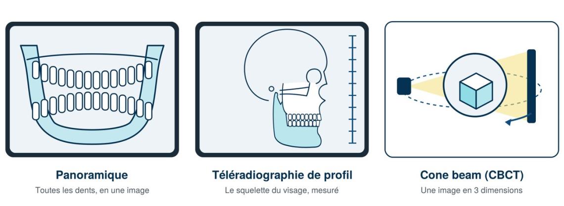 Les trois examens : radiographie panoramique, téléradiographie de profil et cone beam