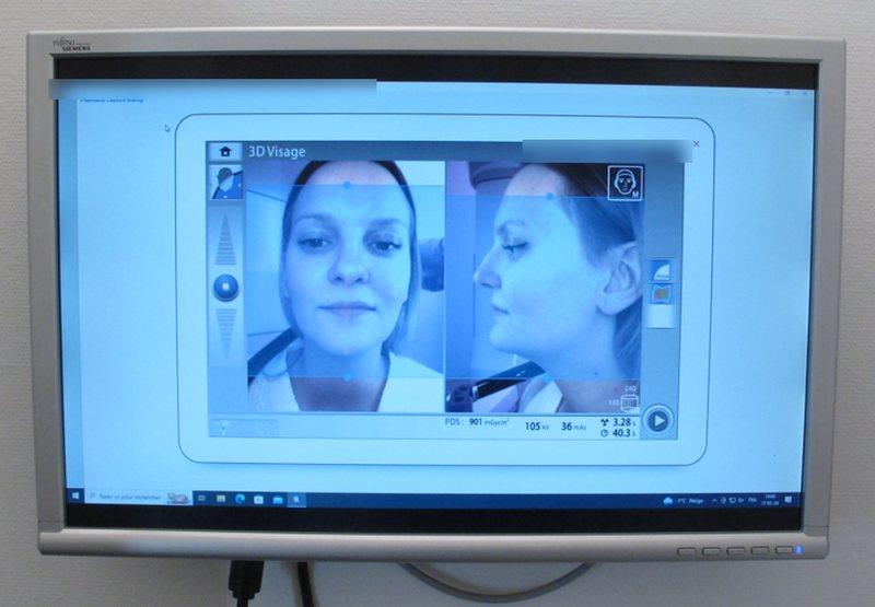 Écran affichant la photographie 3D du visage, de face et de profil